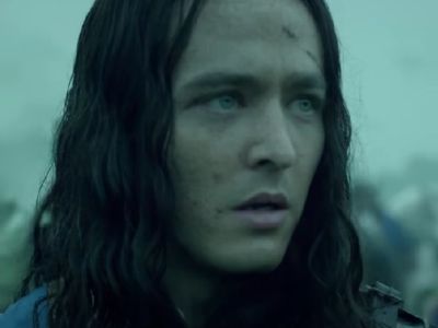 Alexander Vlahos has long hair and some scars on his forehead.